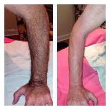 Male Full Arm