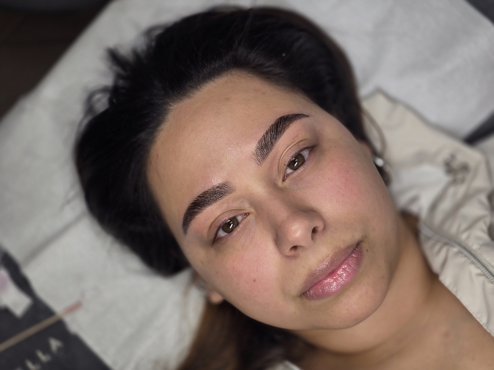 Brow bundle
