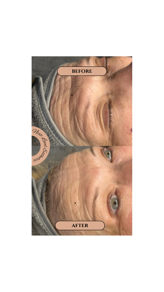 Our Ageless Signature Facial