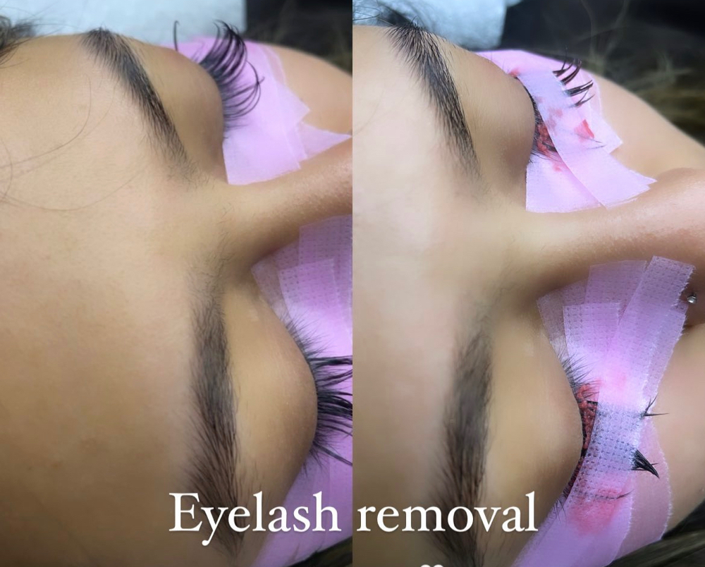 Eyelash Removal ŹŃÉ