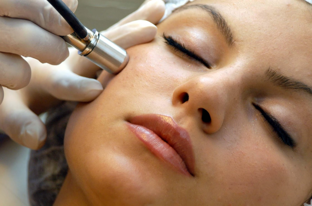 Add-on Microdermabrasion