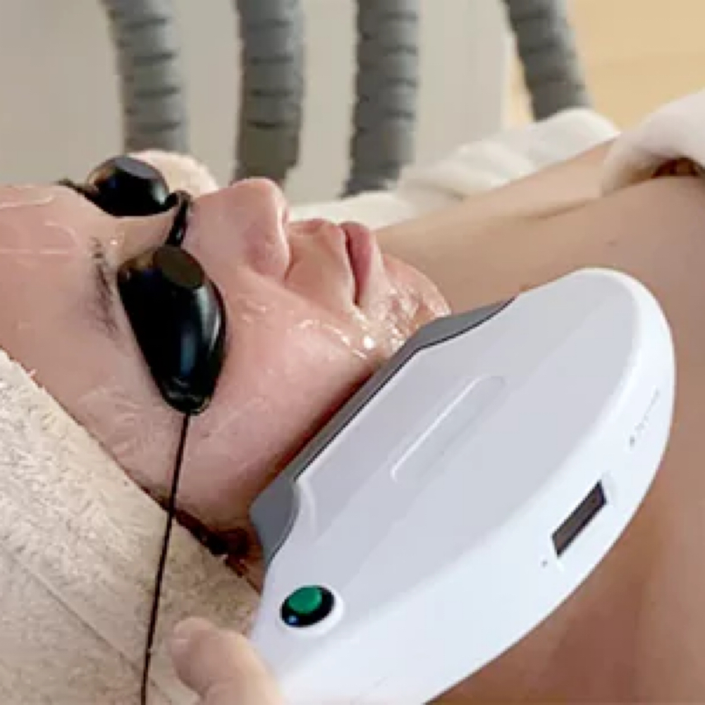 IPL - Underarms at Belle Vie Esthetics by Andreia Miranda in Natick, MA
