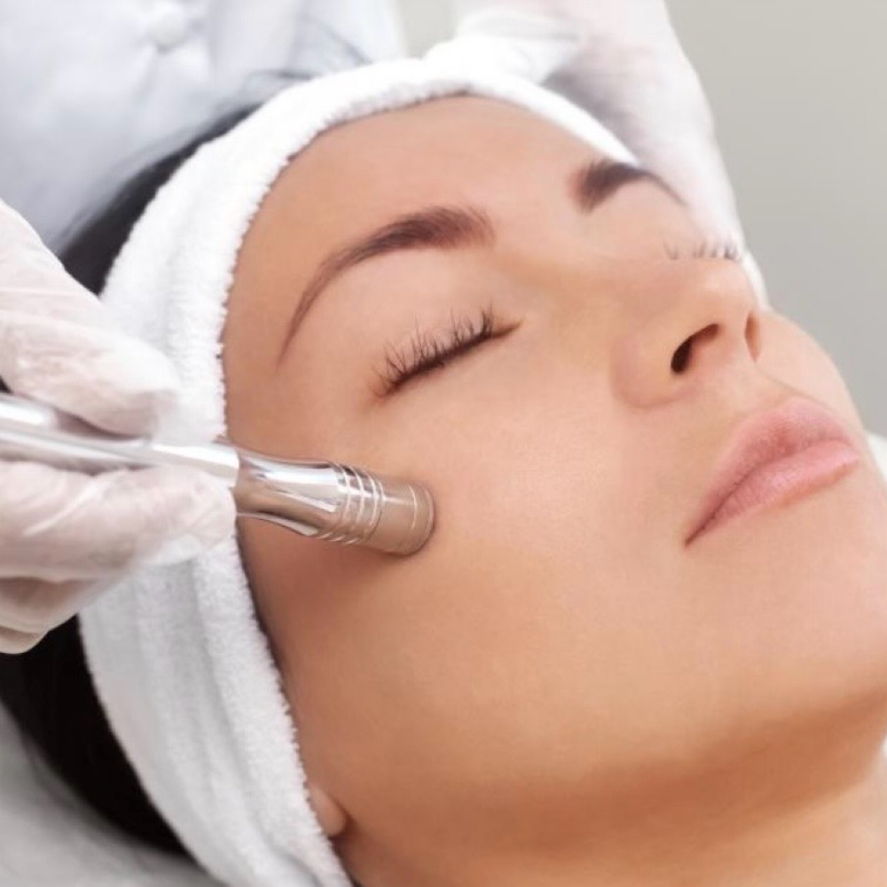 Microdermabrasion session at Forever Young Esthetics in Windsor, CO