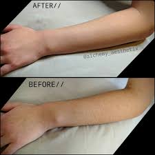 Female Full Arm