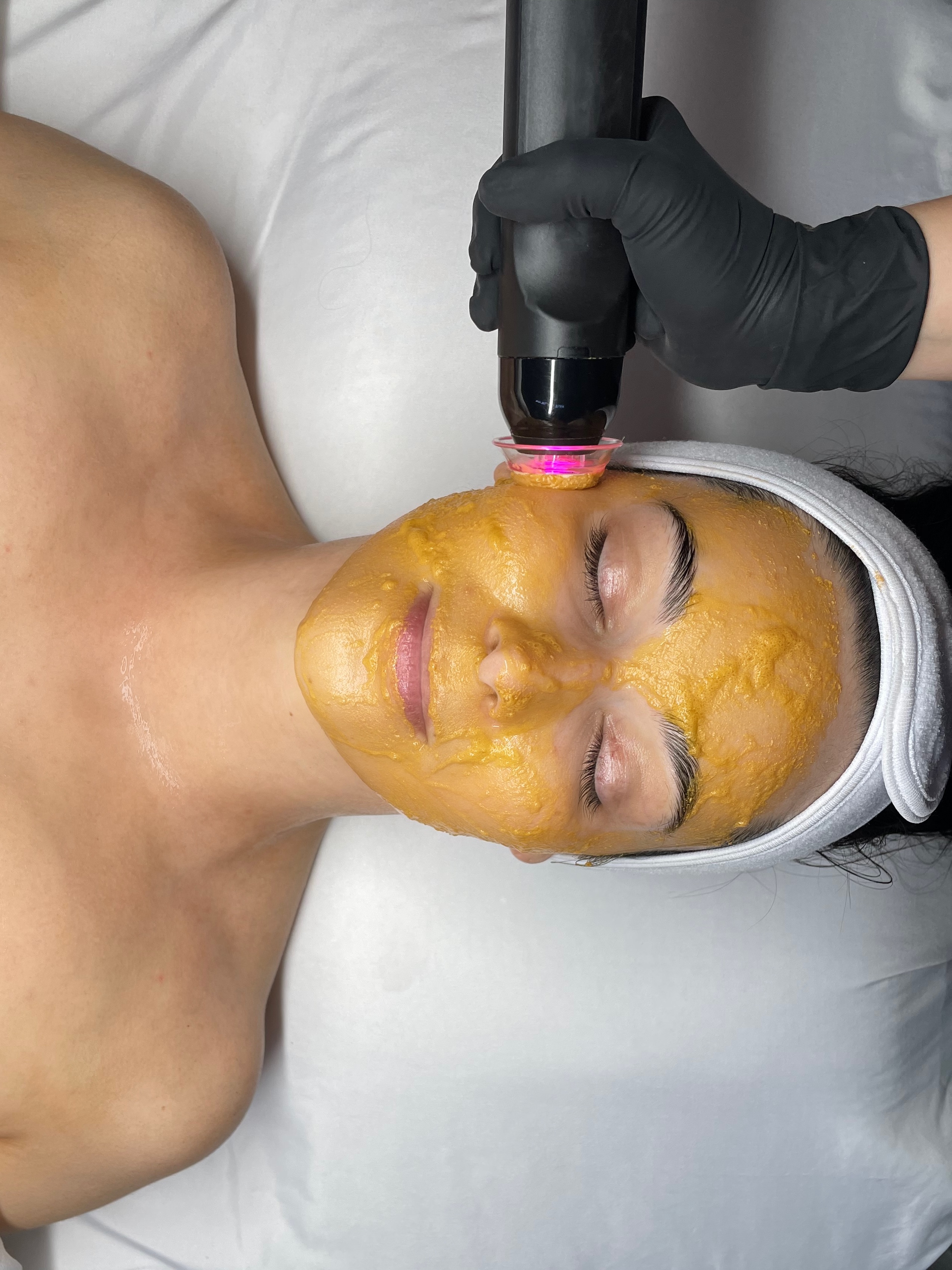 Dermaplane & Glo2Facial (Mondays)