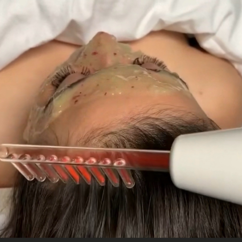 Dry Scalp Therapy at Skincare By Liliya in Sherman Oaks, CA