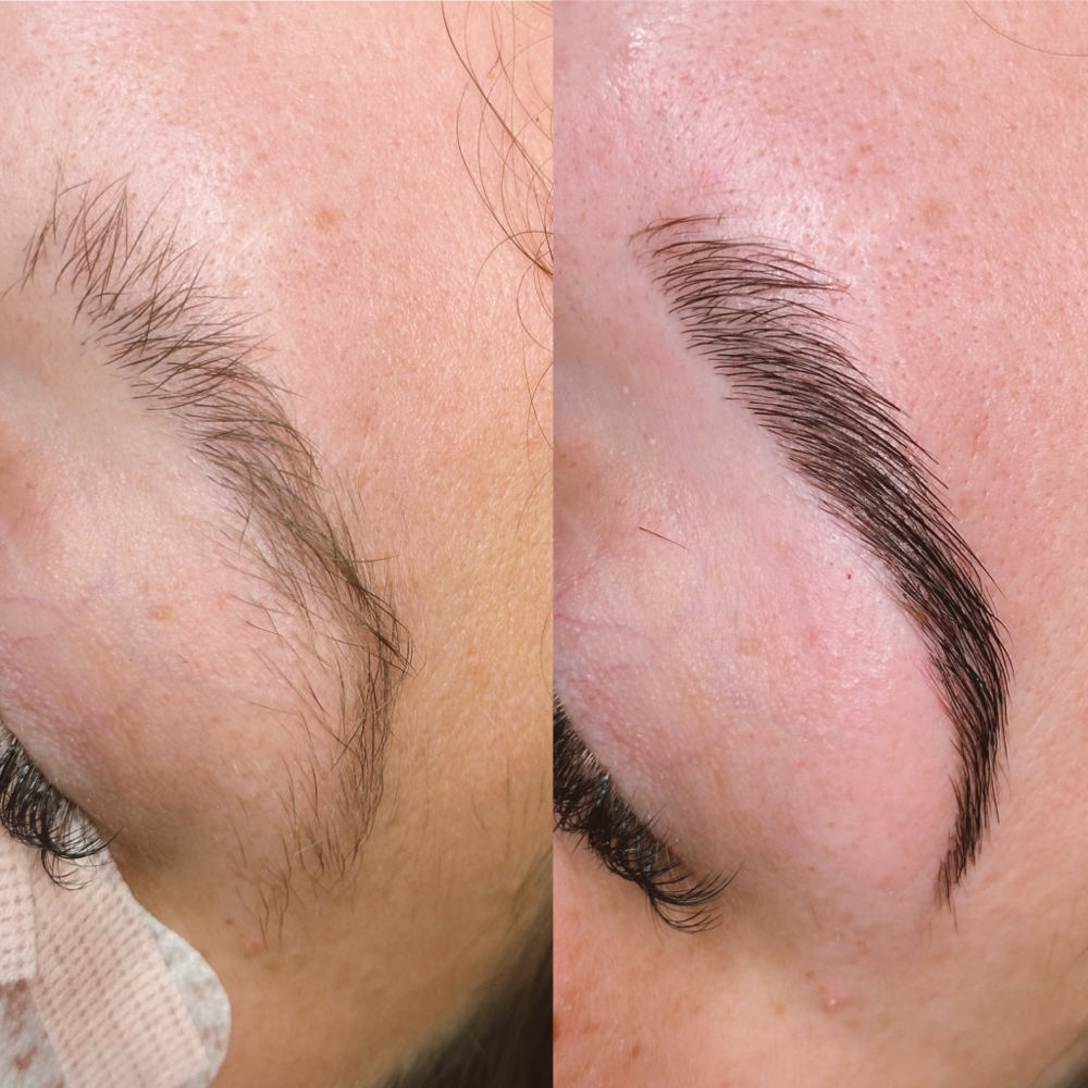 Eyebrow Lamination