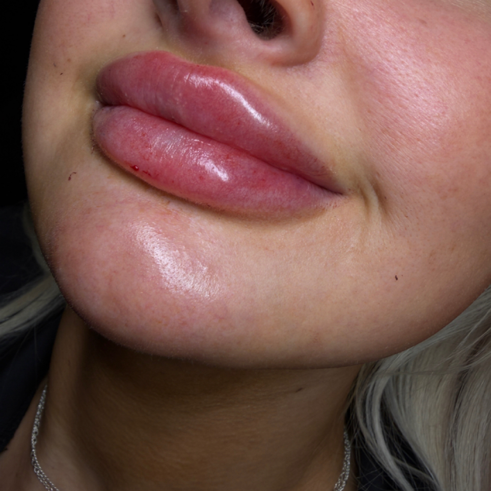 Mega Lips (russian)💋 at InjectorFaiiry in Greenville, TX