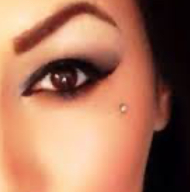 Dermal