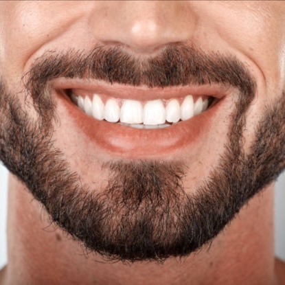 40 Minute Teeth Whitening Session at LUMINOSITY in King Of Prussia, PA