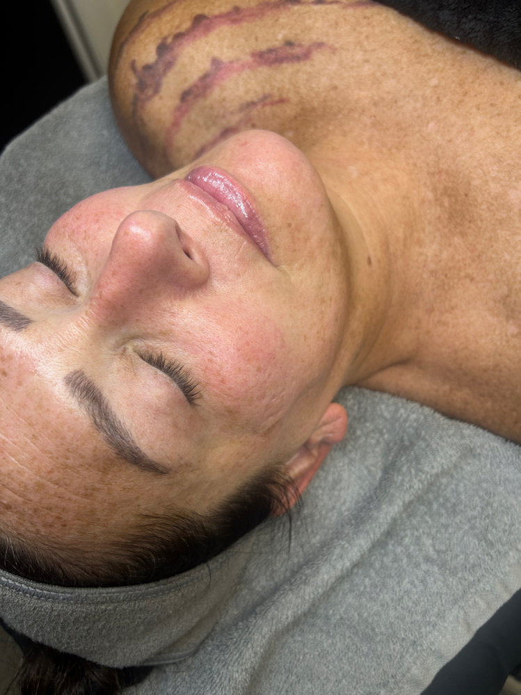 Facial Services