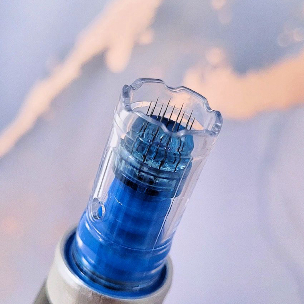 Microneedling at Lavish Esthetics in Capital Heights, MD