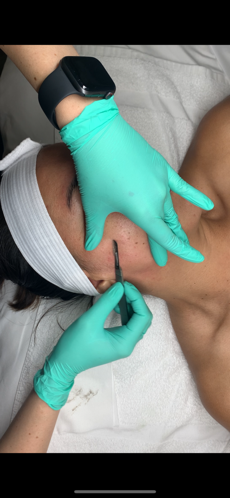 Dermaplaning Facial