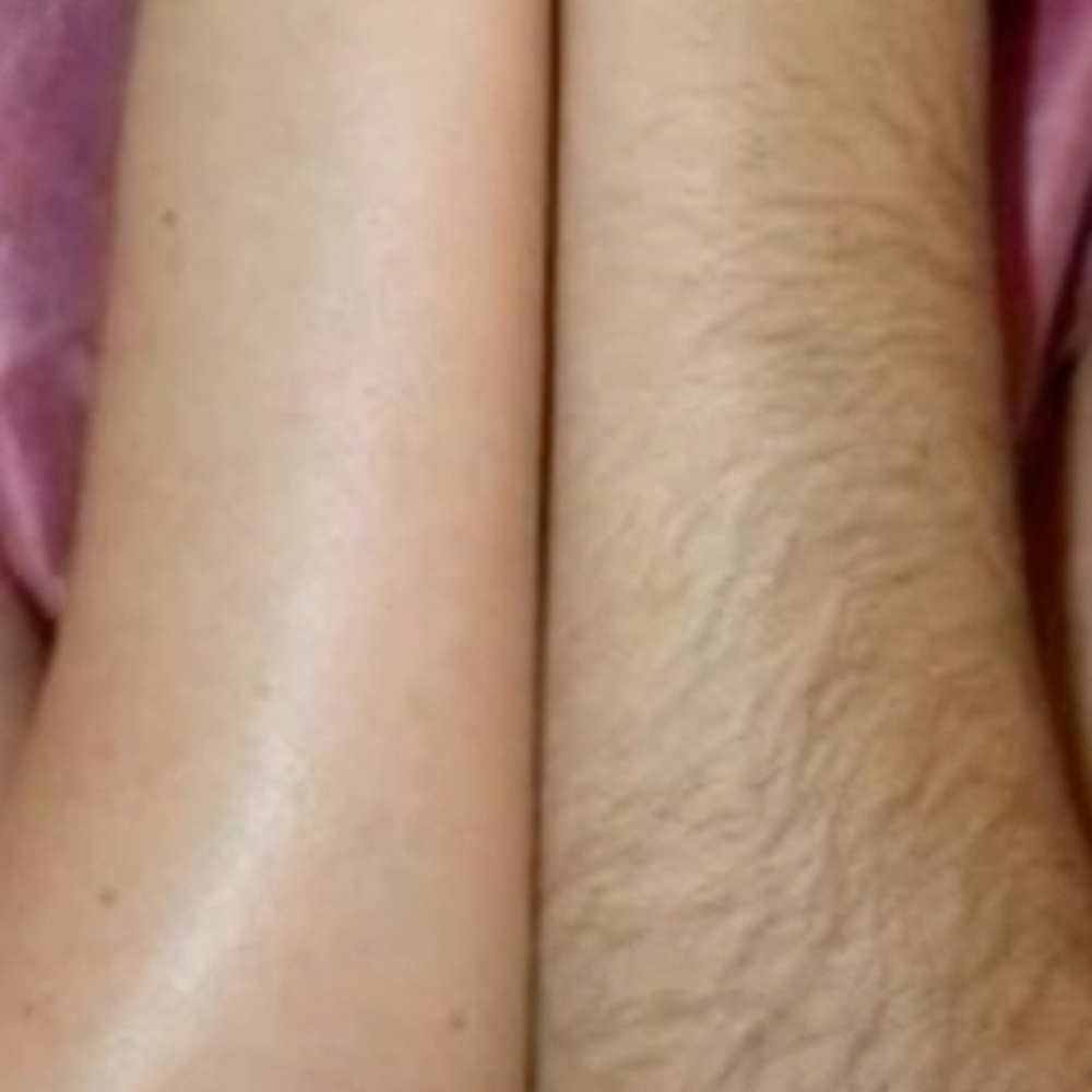 Arms Wax (Full) at Entouch Day Spa  |   La Pine's Premier Facial Spa & Waxing Studio in La Pine, OR