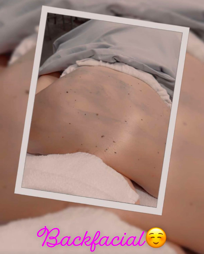 Back Facial