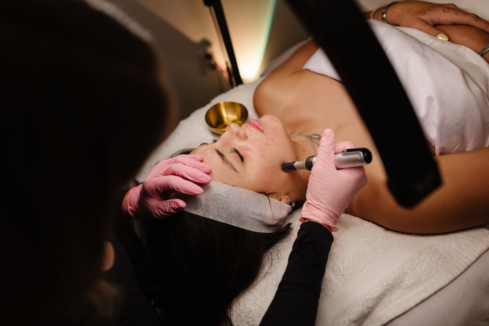 Microneedling NECK at Golden Skin Bar in Mesa, AZ