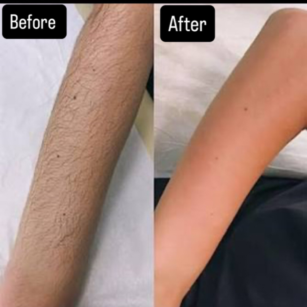 Full Arm Wax at Queensmade Esthetics in Wilmington, NC