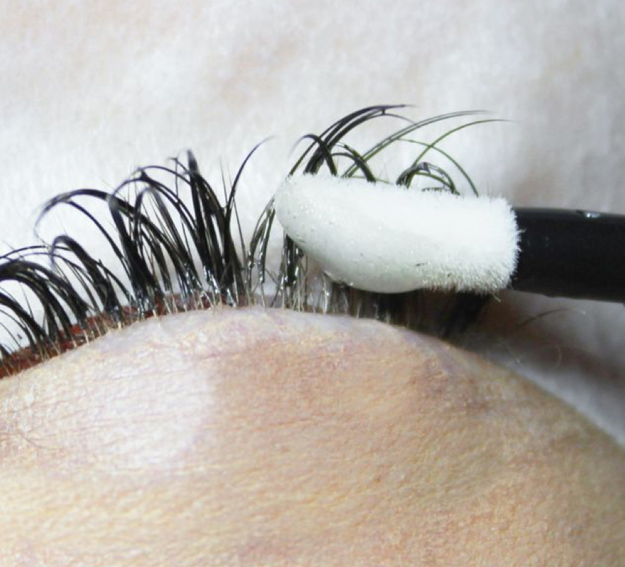 LASH EXTENSION REMOVAL
