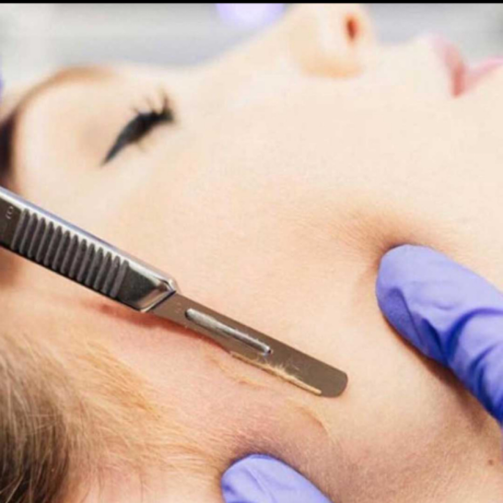 Dermaplaining Facial at Bloom Aesthetics LLC in Fayetteville, NC