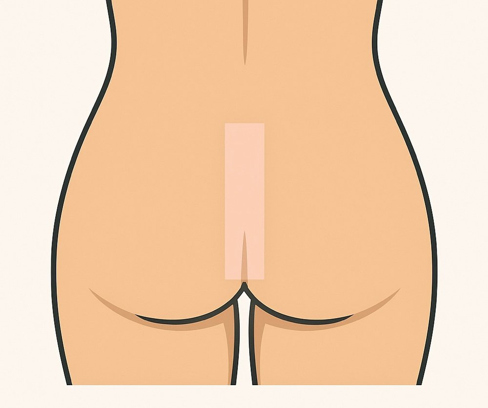Butt Strip at BareSkinAesthetics in Ridgeland, MS