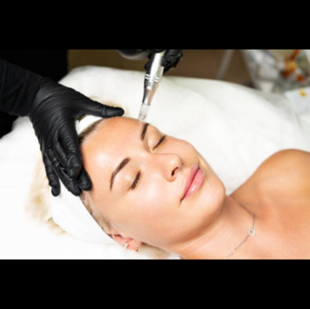 Microneedling at Lush and Lifted, LLC