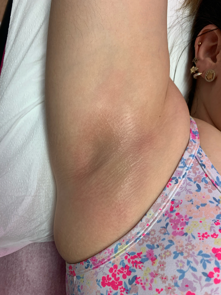 Under Arm Wax