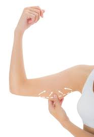 RF Arm Treatment