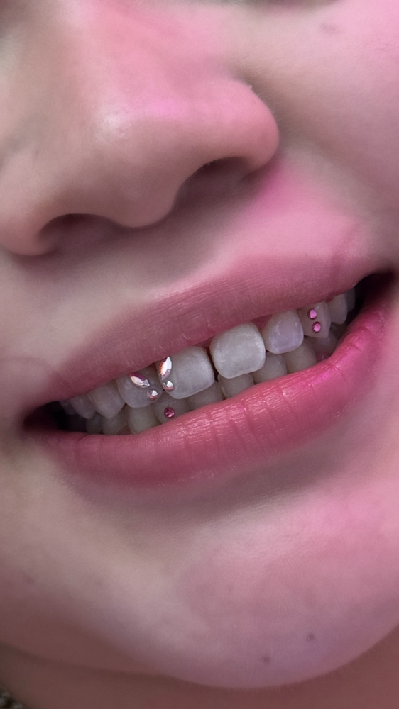 Tooth Gems at Embellished Halo Esthetics in Thornton, CO