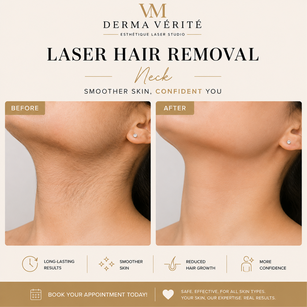 Laser Hair Removal -Neck at Derma Verite Esthetique Laser Studio in Elmhurst, NY