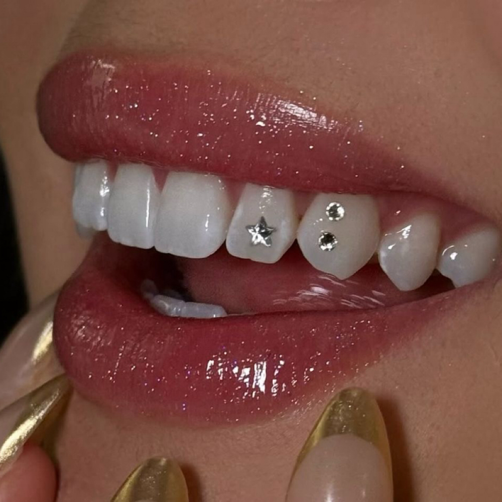Tooth Gems at LauLux Esthetics in Bellerose, NY