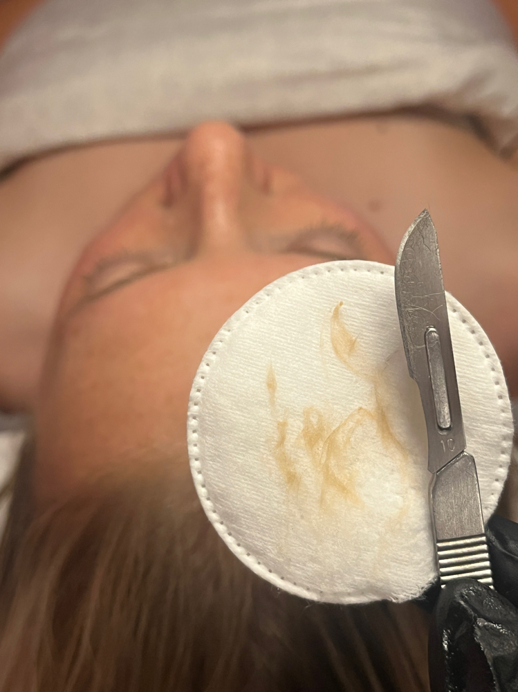 Dermaplaning Facial