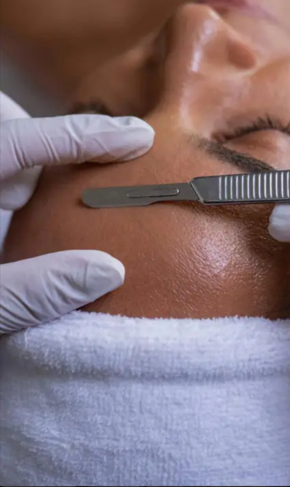 Dermaplaning