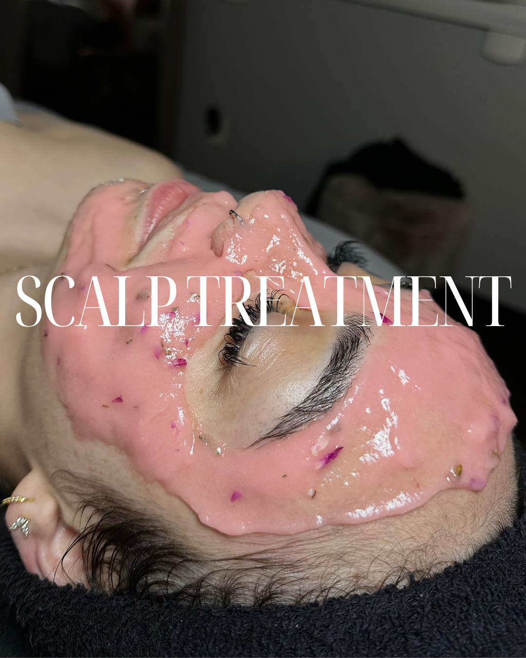 Scalp Treatment
