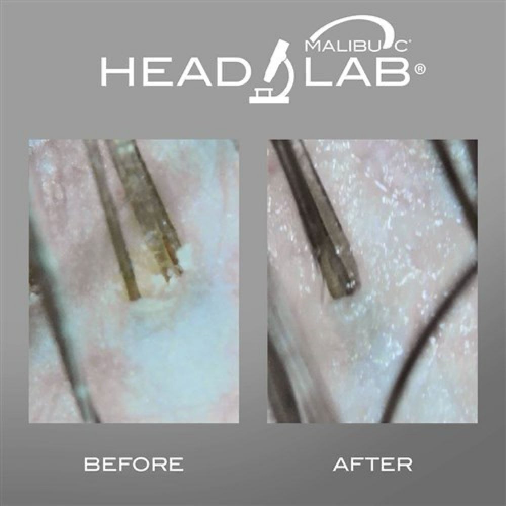 Scalp Detox Treatment at Texas Couture Hair in Kemah, TX