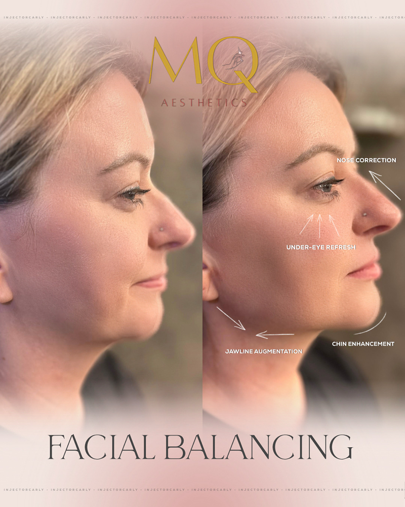 Facial Balancing