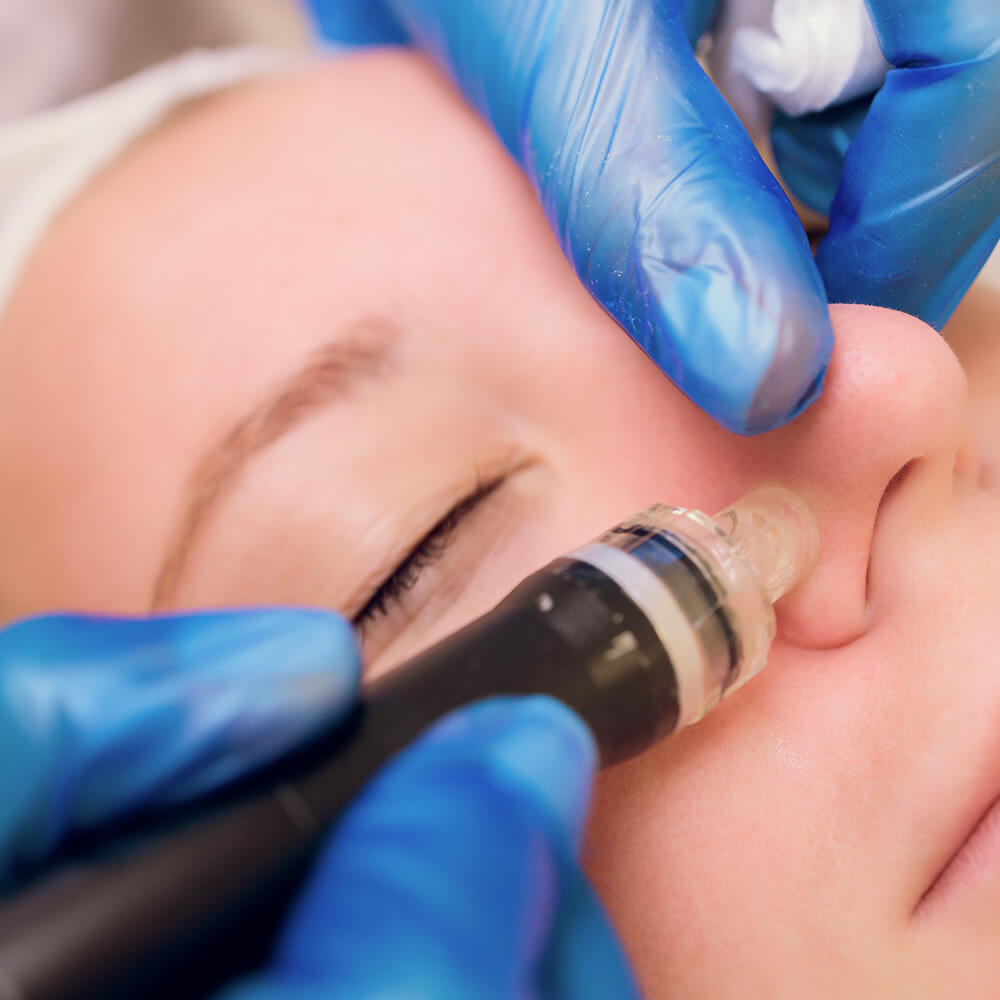 Pore Vacuum
