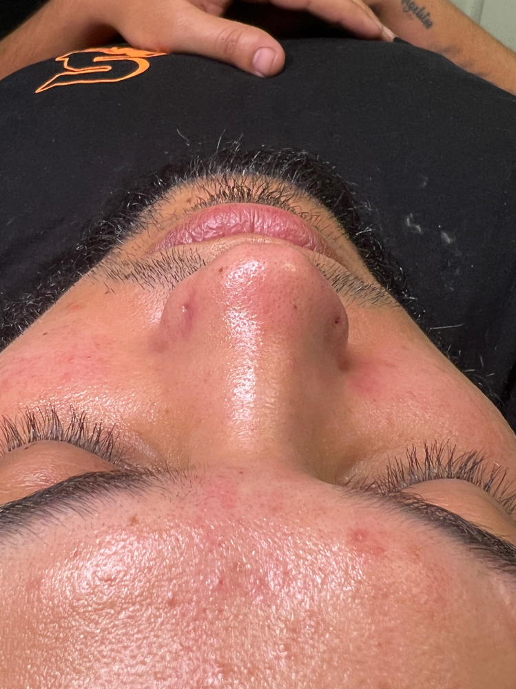Hydrating Glow Facial