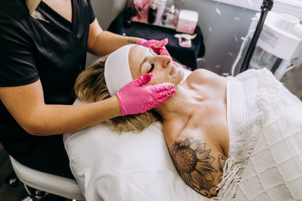 Chemical Peel Facial