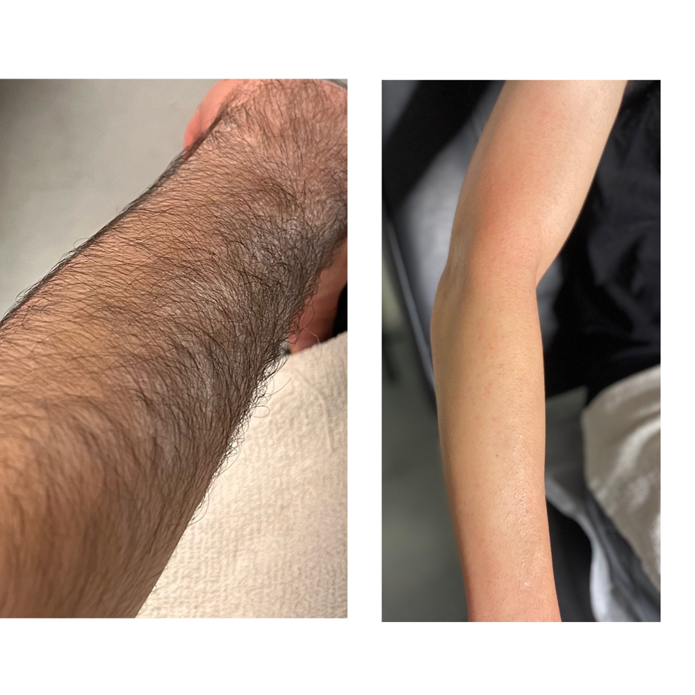 FULL Arms
