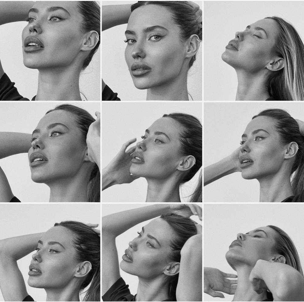 Jawline Filler