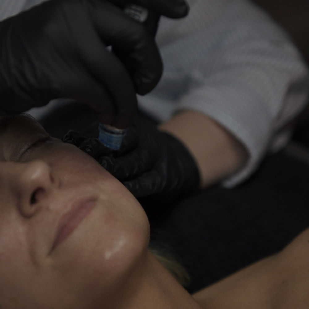 Hydrafacial Treatments at Kind Skin by Jess in London, KY