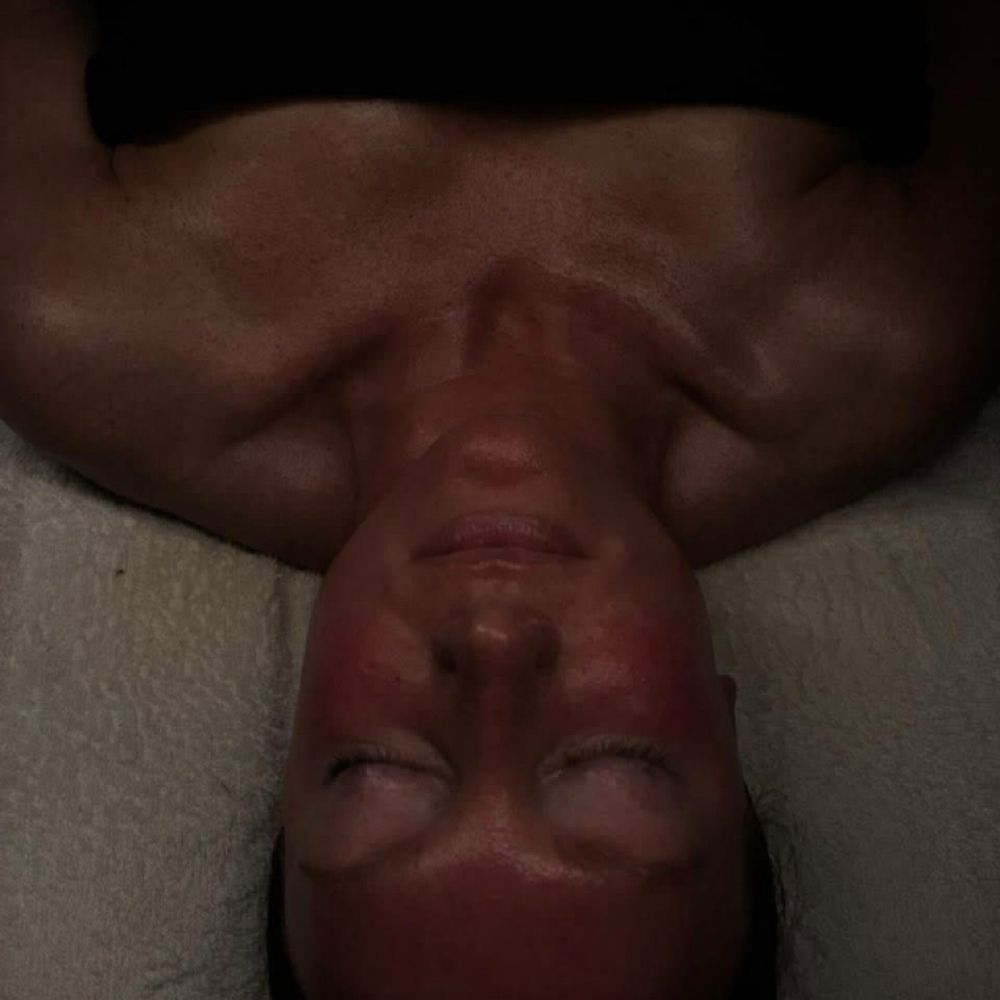 THE CHEMICAL PEEL FACIAL at Face. By Olivia in Kennett, MO