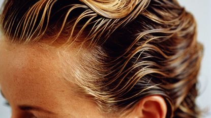 Scalp Treatment