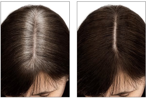 Root Touch Up