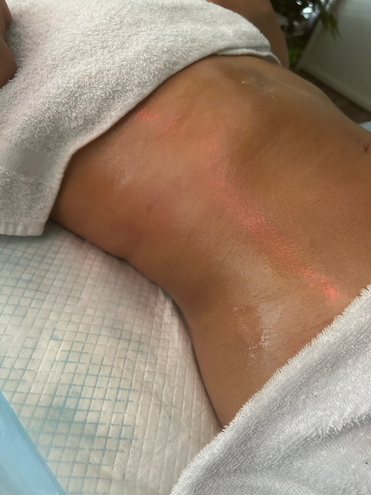 Cosmetic Contour Support at Her Contour & Wellness, LLC in Antioch, CA