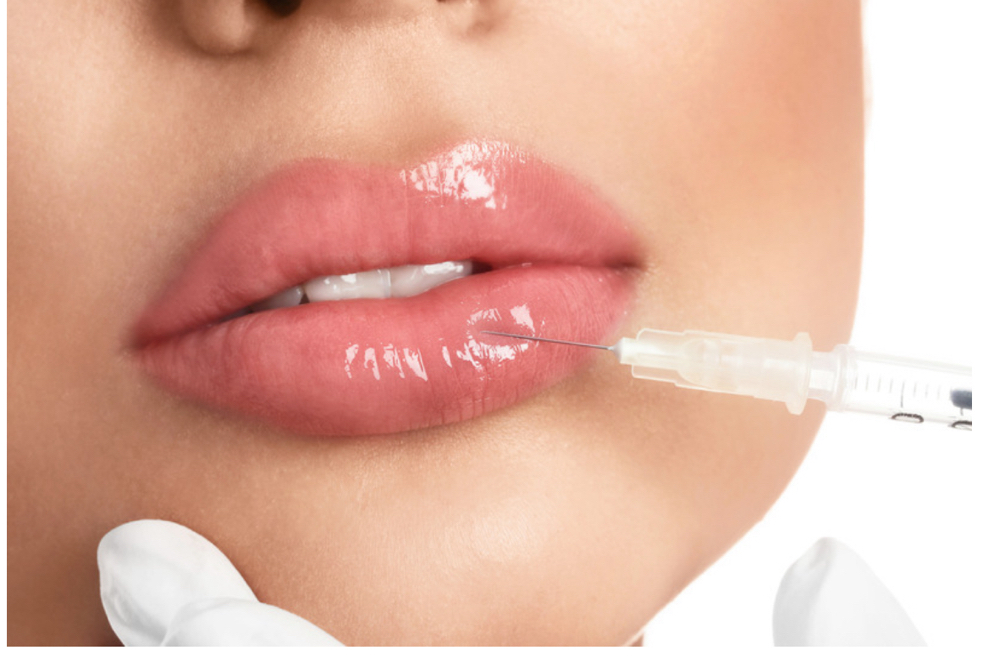 Perfect Pout (Lip Filler) at Christina Lee Injx in Houston, TX