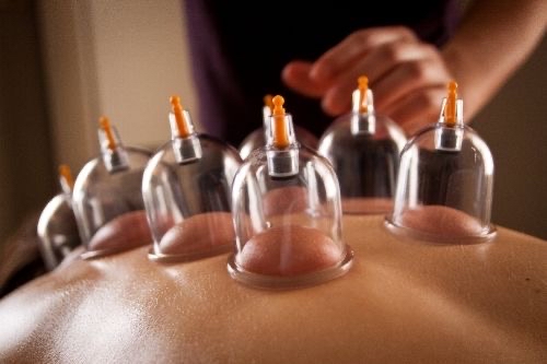 60 Minute Cupping Therapy & Massage