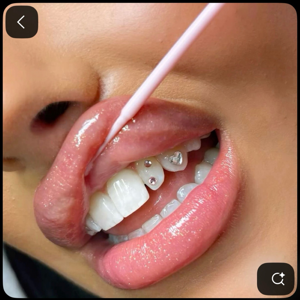 2-3 Tooth Gems at Ice Queen Whitening in Hillsboro, OR