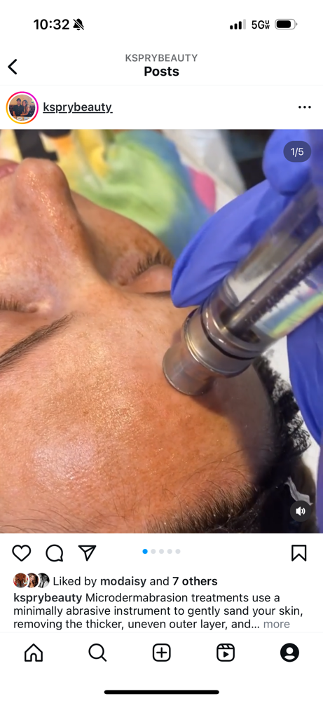 Microdermabrasion