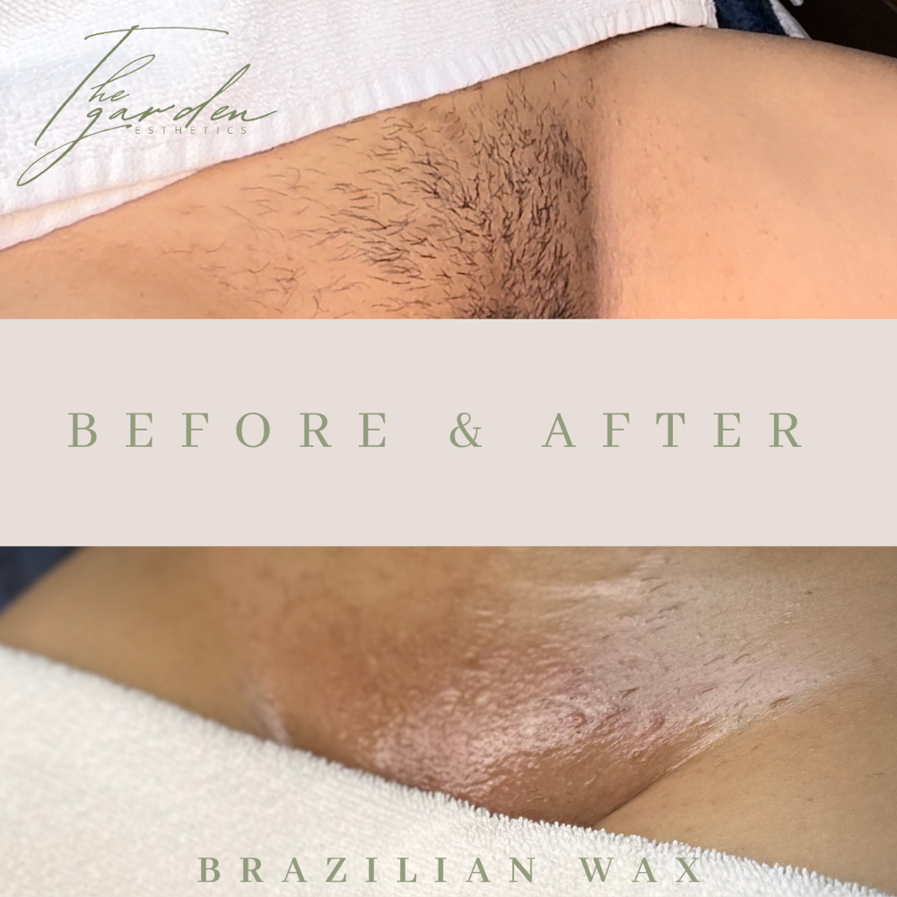 Brazilian Wax